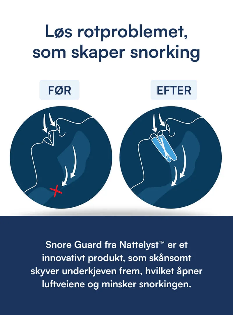 Snorkepakken